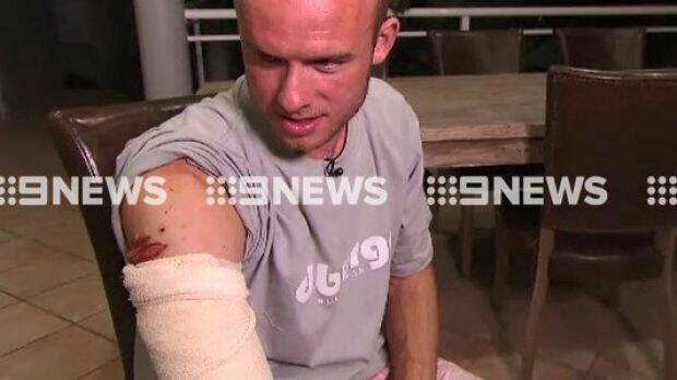 British doctor Charlie Fry was bitten on the shoulder after punching away a shark. Photo: Nine News