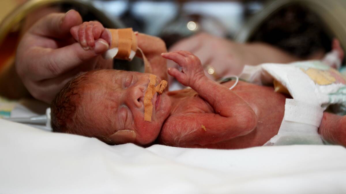 HELPING HAND: The unit cares for more than 1100 premature and sick newborns each year and is one of the largest neonatal units in NSW. Picture: Natalia Grono