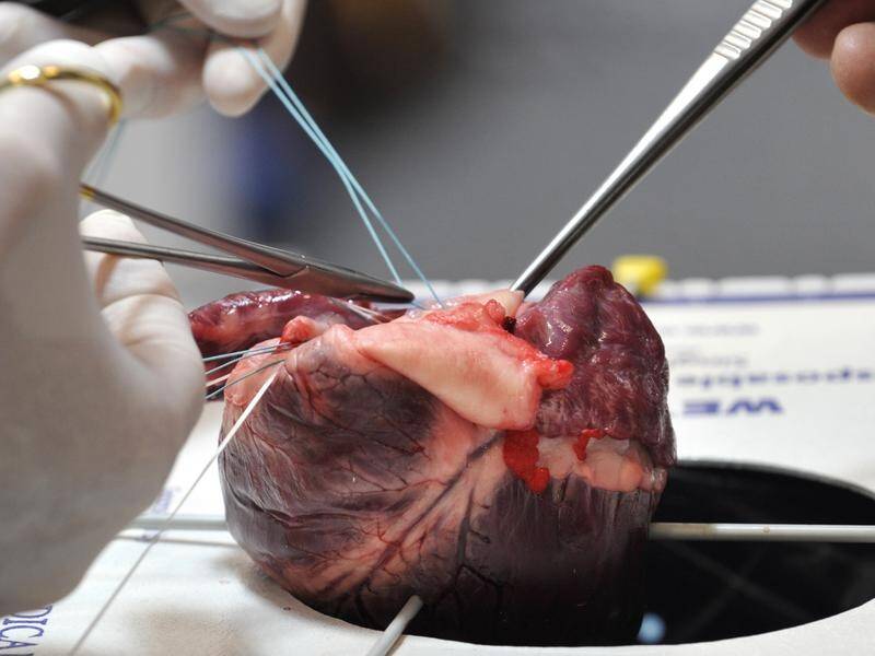 Pigs' heart anatomy is similar to humans so they are used as models for developing new treatments.